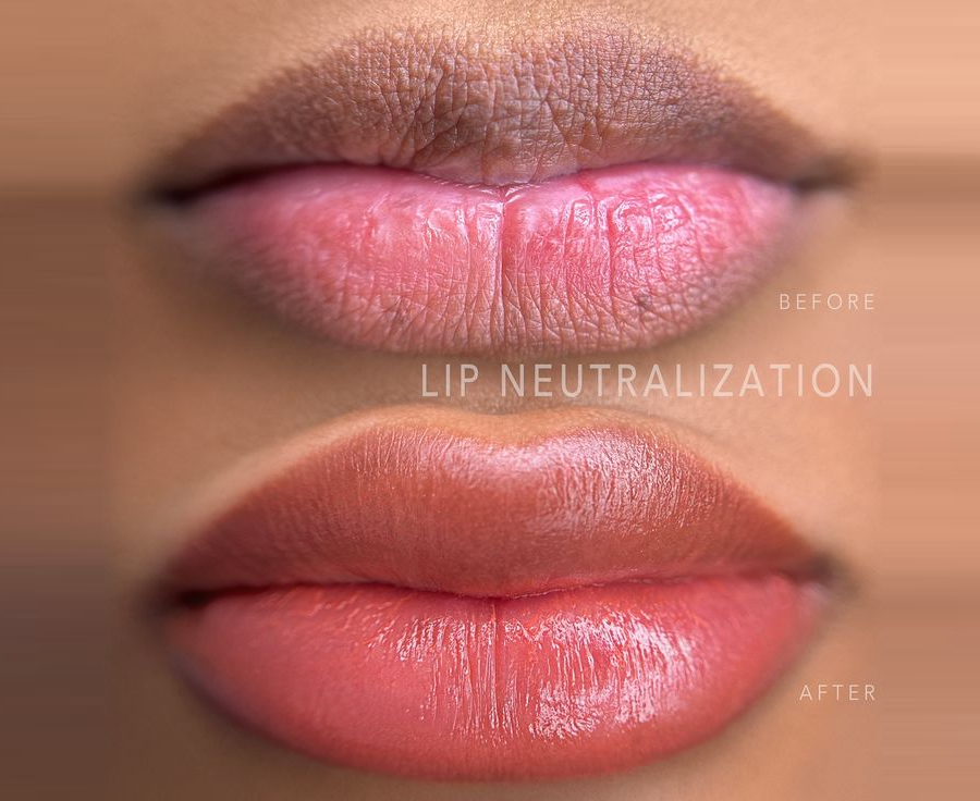 Lips